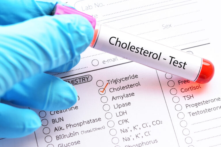 flagler fl, Understanding High Cholesterol